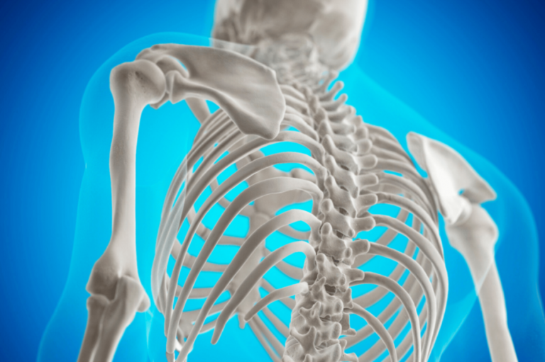 Osteoporose